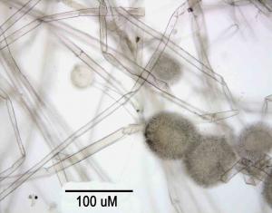 Aspergillus mikroskopski prikaz